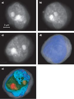 FIGURE 1. Two-dimensional (2D) maximum-intensity projections in different orientations are created from a 3D reconstruction of a squamous-cancer cell (a-c). The figure also shows the same cell from the perspective in (c), whole and cropped, where coloring and opacity have been adjusted to enhance cell features. In (d) and (e), cytoplasm is in translucent gray, the nuclear wall is in opaque blue, and the nucleoplasm is rendered in a green to red gradient, with nucleoli in opaque red. FIGURE 1. Two-dimensional (2D) maximum-intensity projections in different orientations are created from a 3D reconstruction of a squamous-cancer cell (a-c). The figure also shows the same cell from the perspective in (c), whole and cropped, where coloring and opacity have been adjusted to enhance cell features. In (d) and (e), cytoplasm is in translucent gray, the nuclear wall is in opaque blue, and the nucleoplasm is rendered in a green to red gradient, with nucleoli in opaque red.