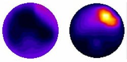 FIGURE 3. Diffuse optical spectroscopy looks at hemoglobin concentrations and level of tissue oxygenation to distinguish cancerous tissue from healthy tissue with an average specificity of 89%. This image shows slices across 3D reconstructions of the hemoglobin concentration in the left and right breast of a 58-year-old woman with Grade II invasive carcinoma in the upper outer quadrant of the left breast. FIGURE 3. Diffuse optical spectroscopy looks at hemoglobin concentrations and level of tissue oxygenation to distinguish cancerous tissue from healthy tissue with an average specificity of 89%. This image shows slices across 3D reconstructions of the hemoglobin concentration in the left and right breast of a 58-year-old woman with Grade II invasive carcinoma in the upper outer quadrant of the left breast.