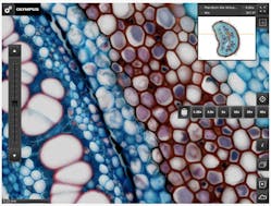 Olympus&apos;s free OlyVIA Mobile iPad App provides flexible access to microscopy images at various resolutions.