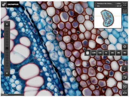 Olympus&apos;s free OlyVIA Mobile iPad App provides flexible access to microscopy images at various resolutions.