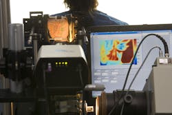 Spatially modulated imaging quantitatively maps absorption and scattering in skin. Spatially modulated imaging quantitatively maps absorption and scattering in skin.