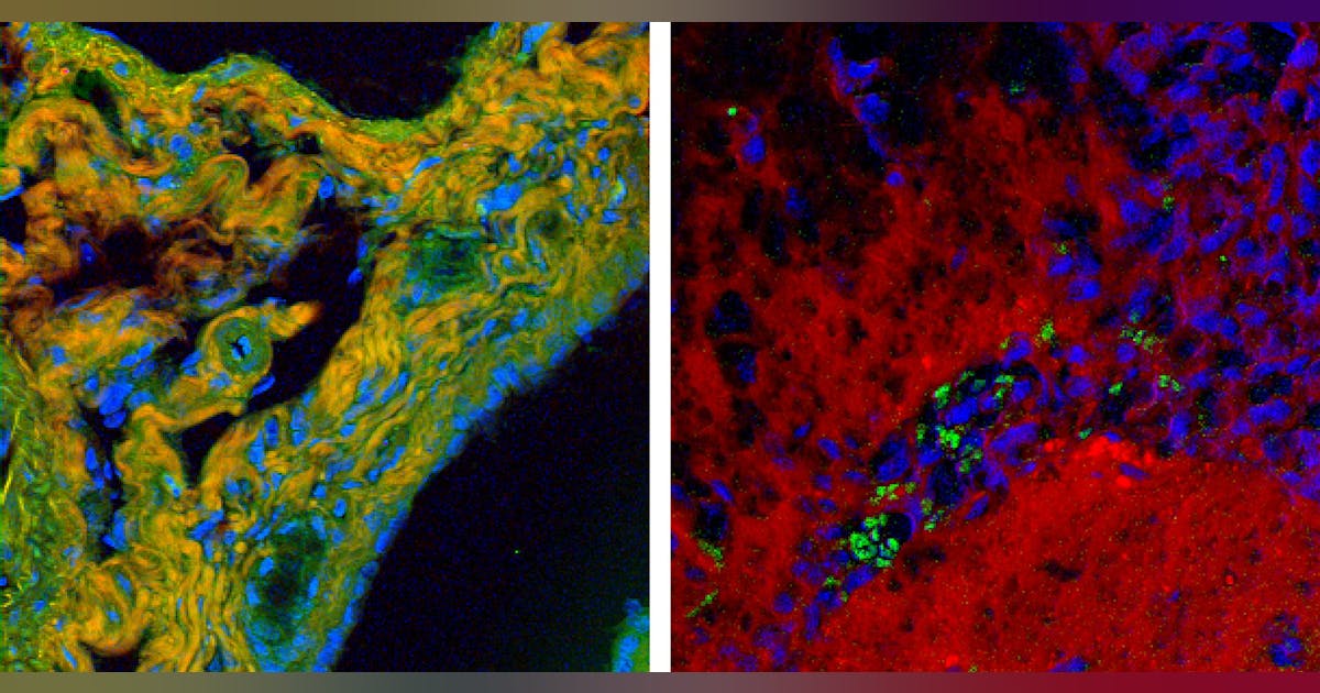 CELL BIOLOGY/HYPERSPECTRAL RAMAN: Dramatic boost in Raman signal ...