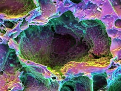 FIGURE 9. Arany and his colleagues have been researching light-facilitated dentin generation using poly-lactide-co-glycolide scaffolding to assess 3D differentiation of the subject’s own stem cells. FIGURE 9. Arany and his colleagues have been researching light-facilitated dentin generation using poly-lactide-co-glycolide scaffolding to assess 3D differentiation of the subject’s own stem cells.