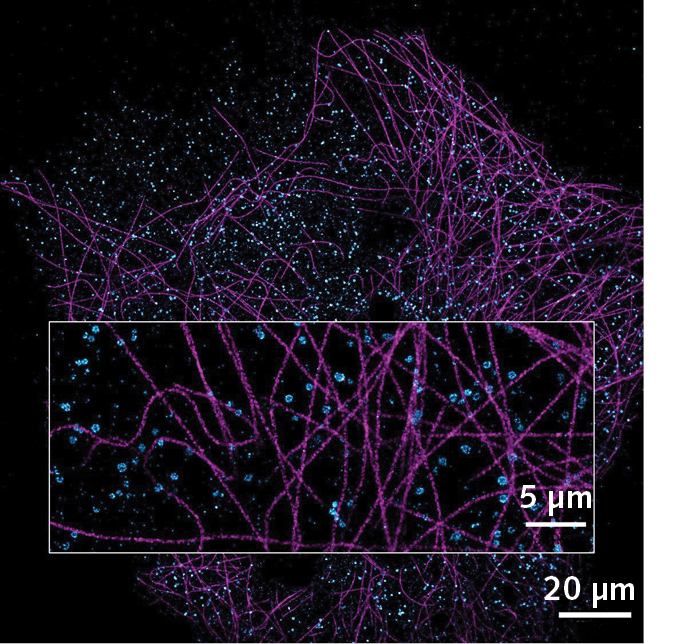 FIGURE 3. Image reconstruction of two simultaneous color acquisitions on Cos7 cells labeled for tubulin-Af647 in magenta and clathrine-CF680 in cyan.
