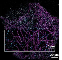 FIGURE 3. Image reconstruction of two simultaneous color acquisitions on Cos7 cells labeled for tubulin-Af647 in magenta and clathrine-CF680 in cyan. FIGURE 3. Image reconstruction of two simultaneous color acquisitions on Cos7 cells labeled for tubulin-Af647 in magenta and clathrine-CF680 in cyan.
