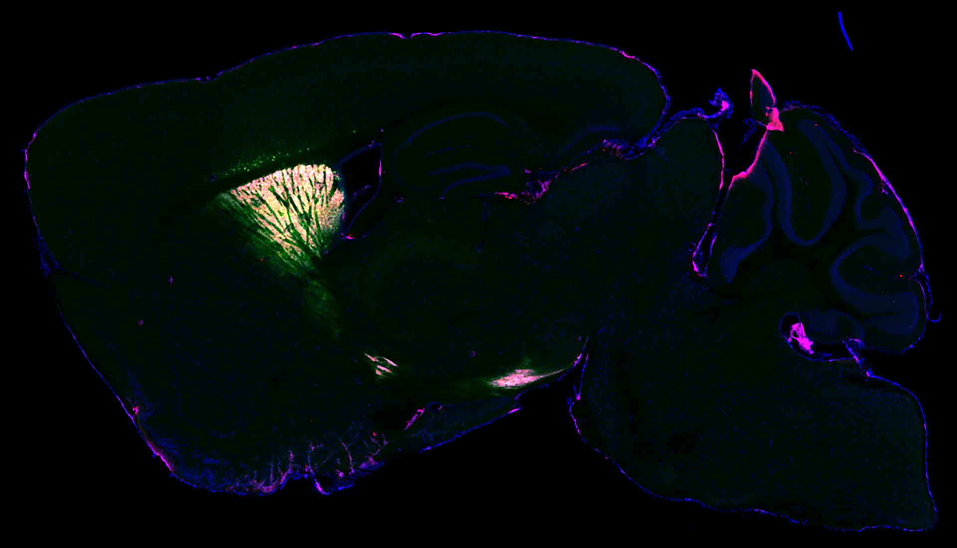 A sagittal cross-section of the mouse striatum. Blue is the outline of the brain, and green and magenta show selectively tagged proteins for mass spectrometry analysis.