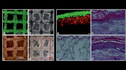 3D printed cell structures (left) include stem cells printed in grid patterns (a) immediately after printing, and later differentiated toward (b) bone, (c) cartilage, and (d) adipose tissue. Histologic sections of skin tissue (right) consist of printed fibroblasts and keratinocytes (a) immediately after printing and (b) 10 days after being implanted in mice, as well as (c) implanted collagen-elastin matrix without printed cells, used as a control, and (d) native mouse skin.