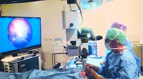 Prof. Dr. med. Claus Eckardt used a surgical microscope with integrated heads-up 3D display to perform ophthalmic surgery, which was broadcast live to an audience of 1200 surgeons at Germany&apos;s 2014 Frankfurt Retina Meeting. The visualization platform consisted of a Leica Microsystems M822 ophthalmic microscope with integrated TrueVision 3D display technology.