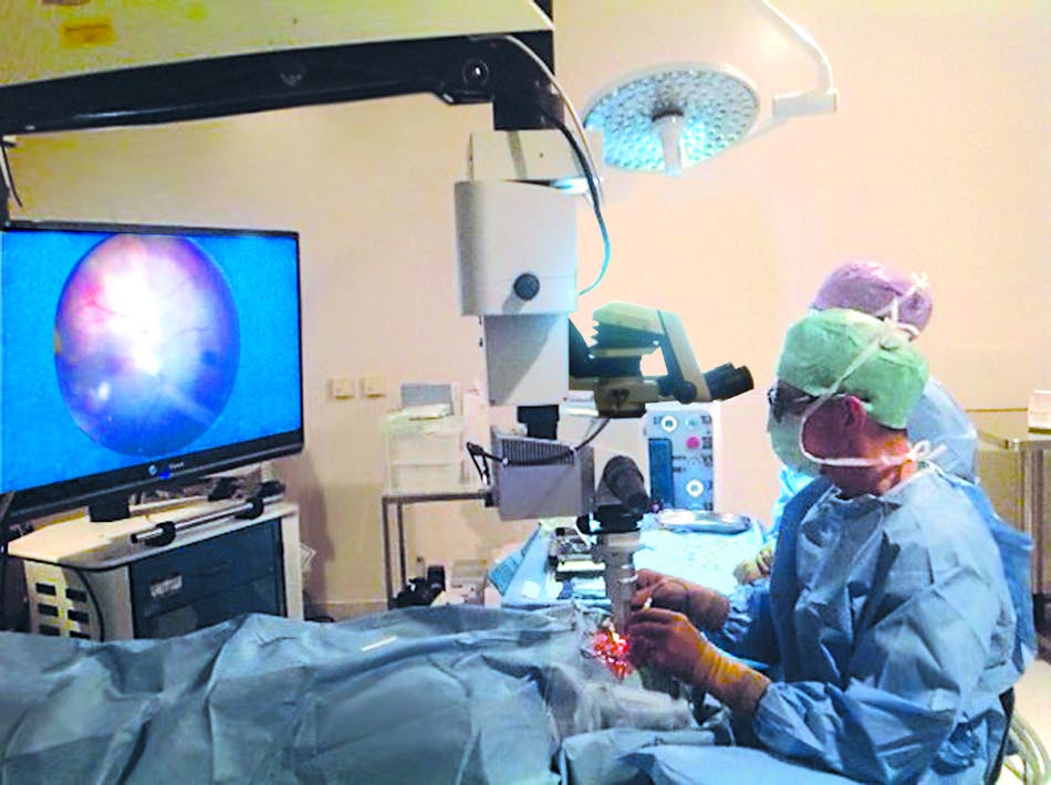Prof. Dr. med. Claus Eckardt used a surgical microscope with integrated heads-up 3D display to perform ophthalmic surgery, which was broadcast live to an audience of 1200 surgeons at Germany&apos;s 2014 Frankfurt Retina Meeting. The visualization platform consisted of a Leica Microsystems M822 ophthalmic microscope with integrated TrueVision 3D display technology.