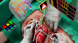 FIGURE 1. Augmented reality can play a particularly useful role in surgery by overlaying critical information about the patient during the actual surgery itself to improve patient outcomes.