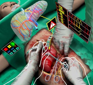 FIGURE 1. Augmented reality can play a particularly useful role in surgery by overlaying critical information about the patient during the actual surgery itself to improve patient outcomes.