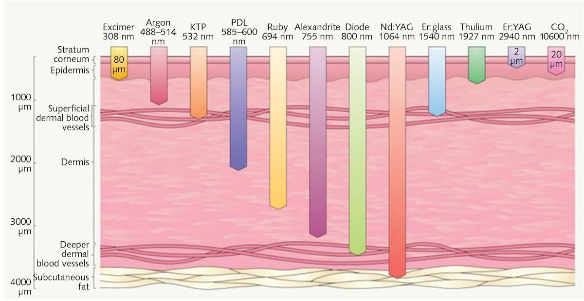 FIGURE 1. Tissue penetration for various types of lasers.