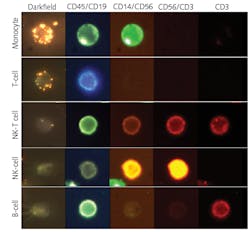 The left column shows gold plasmonic nanoparticles bound to the ovarian cancer marker CA125, while the remaining columns show the multiple fluorescent labels serving to identify the type of immune cell [2].