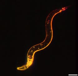FIGURE 2. C. elegans worm image with swept confocally aligned planar excitation microscopy. FIGURE 2. C. elegans worm image with swept confocally aligned planar excitation microscopy.