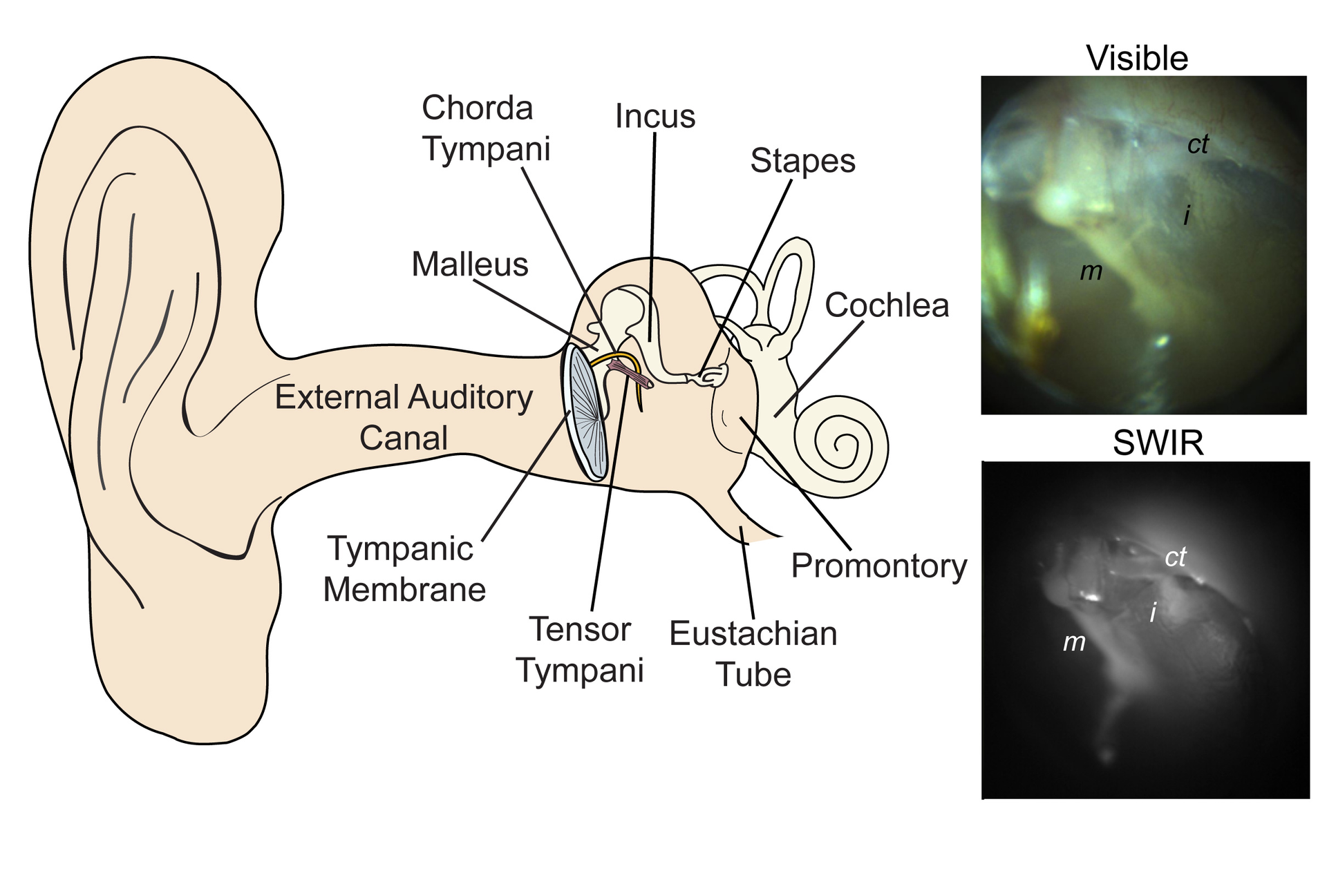 red light therapy for ear infection