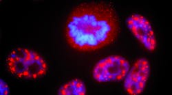 An indirect immunofluorescence image of cells in interphase and mitosis. Presplicing factors are stained red and chromatin stained blue. An indirect immunofluorescence image of cells in interphase and mitosis. Presplicing factors are stained red and chromatin stained blue.
