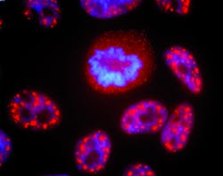 An indirect immunofluorescence image of cells in interphase and mitosis. Presplicing factors are stained red and chromatin stained blue. An indirect immunofluorescence image of cells in interphase and mitosis. Presplicing factors are stained red and chromatin stained blue.