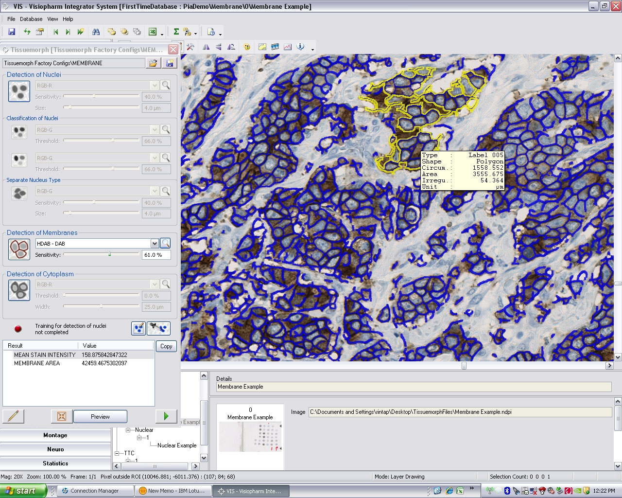 Visiopharm Poster Screen