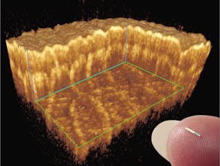 In vivo OCT human skin measurements with 20 &mu;m isotropic resolution are taken using a 1550 nm akinetic laser; a 3D reconstruction of the dataset is shown with a portion of the data removed to reveal the internal structure of the skin.