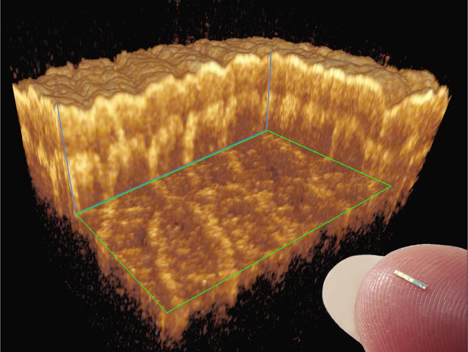 In vivo OCT human skin measurements with 20 &mu;m isotropic resolution are taken using a 1550 nm akinetic laser; a 3D reconstruction of the dataset is shown with a portion of the data removed to reveal the internal structure of the skin.