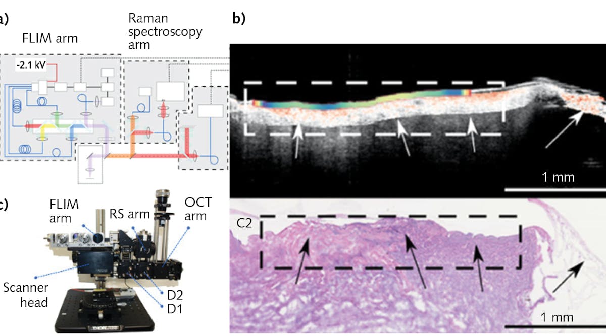 A new multimodal tool combines OCT, fluorescence lifetime (FLIM) imaging, and Raman spectroscopy for rapid and efficient diagnosis (a); the FLIM and OCT data is also shown, with image details correlated with histology results (b).