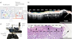 A new multimodal tool combines OCT, fluorescence lifetime (FLIM) imaging, and Raman spectroscopy for rapid and efficient diagnosis (a); the FLIM and OCT data is also shown, with image details correlated with histology results (b). A new multimodal tool combines OCT, fluorescence lifetime (FLIM) imaging, and Raman spectroscopy for rapid and efficient diagnosis (a); the FLIM and OCT data is also shown, with image details correlated with histology results (b).