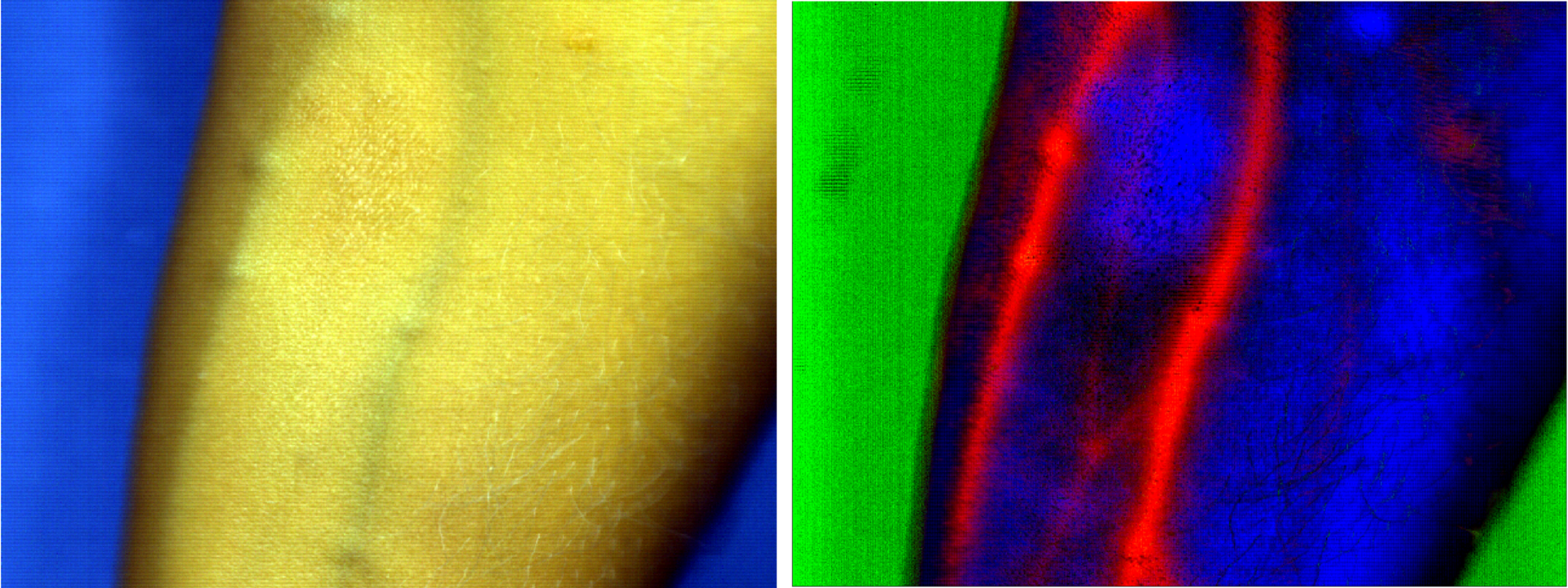 FIGURE 1. Emphasizing blood vessels in the human forearm: an image with the conventional RGB camera (left) and a hyperspectral image in SWIR after processing with IDCube (right) are shown. This datacube was collected using a SWIR-sensitive 2D indium gallium arsenide (InGaAs) camera, Ninox (Raptor Photonics), mounted on top of a SWIR imaging spectrograph (Specim) equipped with a chromatic-aberration-free lens (StingRay Optics) , and was obtained by members of the Berezin Lab at Washington University in St. Louis.