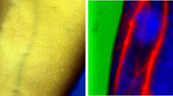 FIGURE 1. Emphasizing blood vessels in the human forearm: an image with the conventional RGB camera (left) and a hyperspectral image in SWIR after processing with IDCube (right) are shown. This datacube was collected using a SWIR-sensitive 2D indium gallium arsenide (InGaAs) camera, Ninox (Raptor Photonics), mounted on top of a SWIR imaging spectrograph (Specim) equipped with a chromatic-aberration-free lens (StingRay Optics) , and was obtained by members of the Berezin Lab at Washington University in St. Louis. FIGURE 1. Emphasizing blood vessels in the human forearm: an image with the conventional RGB camera (left) and a hyperspectral image in SWIR after processing with IDCube (right) are shown. This datacube was collected using a SWIR-sensitive 2D indium gallium arsenide (InGaAs) camera, Ninox (Raptor Photonics), mounted on top of a SWIR imaging spectrograph (Specim) equipped with a chromatic-aberration-free lens (StingRay Optics) , and was obtained by members of the Berezin Lab at Washington University in St. Louis.