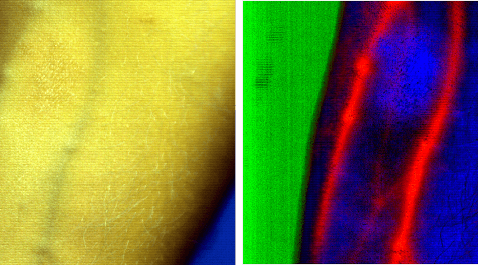 FIGURE 1. Emphasizing blood vessels in the human forearm: an image with the conventional RGB camera (left) and a hyperspectral image in SWIR after processing with IDCube (right) are shown. This datacube was collected using a SWIR-sensitive 2D indium gallium arsenide (InGaAs) camera, Ninox (Raptor Photonics), mounted on top of a SWIR imaging spectrograph (Specim) equipped with a chromatic-aberration-free lens (StingRay Optics) , and was obtained by members of the Berezin Lab at Washington University in St. Louis.