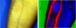 FIGURE 1. Emphasizing blood vessels in the human forearm: an image with the conventional RGB camera (left) and a hyperspectral image in SWIR after processing with IDCube (right) are shown. This datacube was collected using a SWIR-sensitive 2D indium gallium arsenide (InGaAs) camera, Ninox (Raptor Photonics), mounted on top of a SWIR imaging spectrograph (Specim) equipped with a chromatic-aberration-free lens (StingRay Optics) , and was obtained by members of the Berezin Lab at Washington University in St. Louis. FIGURE 1. Emphasizing blood vessels in the human forearm: an image with the conventional RGB camera (left) and a hyperspectral image in SWIR after processing with IDCube (right) are shown. This datacube was collected using a SWIR-sensitive 2D indium gallium arsenide (InGaAs) camera, Ninox (Raptor Photonics), mounted on top of a SWIR imaging spectrograph (Specim) equipped with a chromatic-aberration-free lens (StingRay Optics) , and was obtained by members of the Berezin Lab at Washington University in St. Louis.