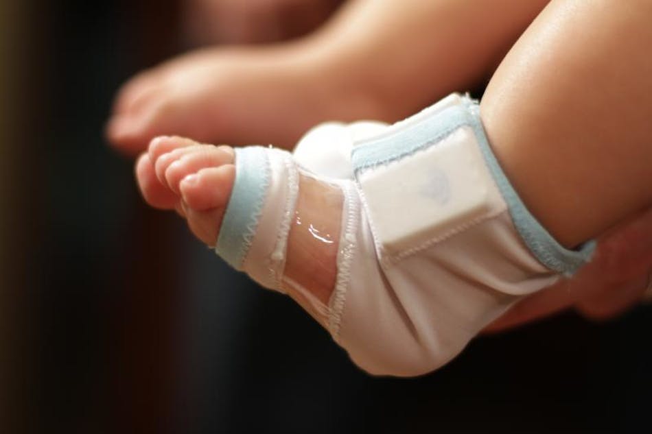Smart sock could monitor baby s vital signs at home Laser Focus