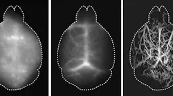 Localization-based DOLI approach operating in the NIR-II spectral window (right) versus conventional widefield fluorescence imaging in the NIR-II window (middle), and in the visible spectral range (left). All of the images were acquired noninvasively.