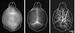 Localization-based DOLI approach operating in the NIR-II spectral window (right) versus conventional widefield fluorescence imaging in the NIR-II window (middle), and in the visible spectral range (left). All of the images were acquired noninvasively. Localization-based DOLI approach operating in the NIR-II spectral window (right) versus conventional widefield fluorescence imaging in the NIR-II window (middle), and in the visible spectral range (left). All of the images were acquired noninvasively.