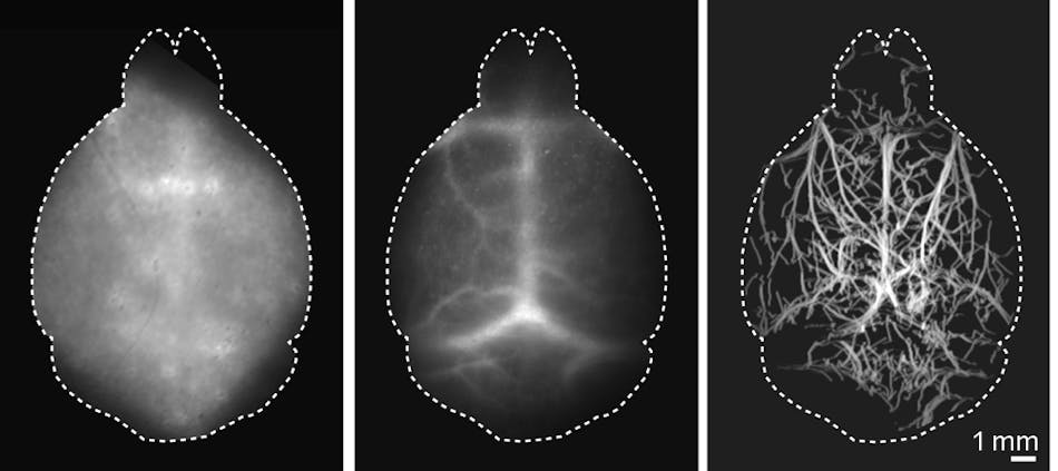 Localization-based DOLI approach operating in the NIR-II spectral window (right) versus conventional widefield fluorescence imaging in the NIR-II window (middle), and in the visible spectral range (left). All of the images were acquired noninvasively.