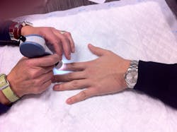 One prototype is a portable microscope which is placed manually on the patient’s fingertip to take videos of microcirculation in very superficial capillaries. One prototype is a portable microscope which is placed manually on the patient’s fingertip to take videos of microcirculation in very superficial capillaries.
