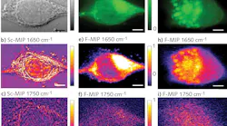 FIGURE 3. Images of living MiaPaca2 cancer cells: Scattering image (a); O-PTIR image at 1650 cm-1 (b); O-PTIR image at 1750 cm-1 (c); fluorescence image stained with Nile red and excited at 532 nm (d); F-PTIR image at 1650 cm-1 (e); F-PTIR image at 1750 cm-1 (f); fluorescence image stained with Rhodamine 123 (Rho123) and excited at 488 nm (g); F-PTIR image at 1650 cm-1 (h); and F-PTIR image at 1750 cm-1 (i).