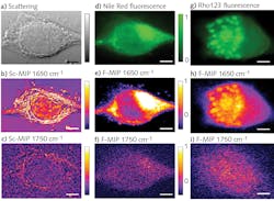 FIGURE 3. Images of living MiaPaca2 cancer cells: Scattering image (a); O-PTIR image at 1650 cm-1 (b); O-PTIR image at 1750 cm-1 (c); fluorescence image stained with Nile red and excited at 532 nm (d); F-PTIR image at 1650 cm-1 (e); F-PTIR image at 1750 cm-1 (f); fluorescence image stained with Rhodamine 123 (Rho123) and excited at 488 nm (g); F-PTIR image at 1650 cm-1 (h); and F-PTIR image at 1750 cm-1 (i). FIGURE 3. Images of living MiaPaca2 cancer cells: Scattering image (a); O-PTIR image at 1650 cm-1 (b); O-PTIR image at 1750 cm-1 (c); fluorescence image stained with Nile red and excited at 532 nm (d); F-PTIR image at 1650 cm-1 (e); F-PTIR image at 1750 cm-1 (f); fluorescence image stained with Rhodamine 123 (Rho123) and excited at 488 nm (g); F-PTIR image at 1650 cm-1 (h); and F-PTIR image at 1750 cm-1 (i).
