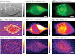 FIGURE 3. Images of living MiaPaca2 cancer cells: Scattering image (a); O-PTIR image at 1650 cm-1 (b); O-PTIR image at 1750 cm-1 (c); fluorescence image stained with Nile red and excited at 532 nm (d); F-PTIR image at 1650 cm-1 (e); F-PTIR image at 1750 cm-1 (f); fluorescence image stained with Rhodamine 123 (Rho123) and excited at 488 nm (g); F-PTIR image at 1650 cm-1 (h); and F-PTIR image at 1750 cm-1 (i). FIGURE 3. Images of living MiaPaca2 cancer cells: Scattering image (a); O-PTIR image at 1650 cm-1 (b); O-PTIR image at 1750 cm-1 (c); fluorescence image stained with Nile red and excited at 532 nm (d); F-PTIR image at 1650 cm-1 (e); F-PTIR image at 1750 cm-1 (f); fluorescence image stained with Rhodamine 123 (Rho123) and excited at 488 nm (g); F-PTIR image at 1650 cm-1 (h); and F-PTIR image at 1750 cm-1 (i).