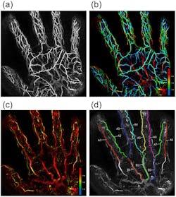 FIGURE 3. PAI blood vessel image of a palm taken at a wavelength of 795 nm. (a) Total grayscale PA signal; (b) false-color PA image representing the depth; (c) PA image after removing surface veins; (d) binarized and labeled final image [4].