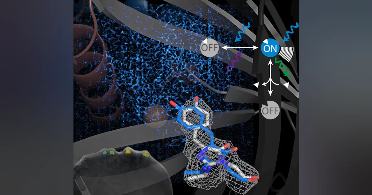 Bioimaging Mri The rapid advance of bioimaging | Laser Focus World