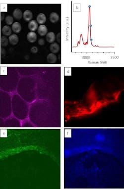 A new simplified source can produce images of specific molecules using CARS microscopy, as in the images of polystyrene microspheres (a) and adipose tissue (c). The same source can also produce second-harmonic generation images and two-photon autofluorescence images, as in the micrographs of rat tendon and bone (d, e, and f). A new simplified source can produce images of specific molecules using CARS microscopy, as in the images of polystyrene microspheres (a) and adipose tissue (c). The same source can also produce second-harmonic generation images and two-photon autofluorescence images, as in the micrographs of rat tendon and bone (d, e, and f).