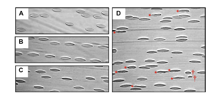 Researchers have developed a technique that allows real-time detection of abnormal and damaged red blood cells to potentially diagnose that damage earlier and more effectively treat it.