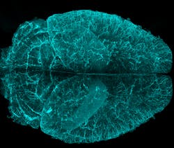 Imaris 61a91269c647d Imaris 61a91269c647d