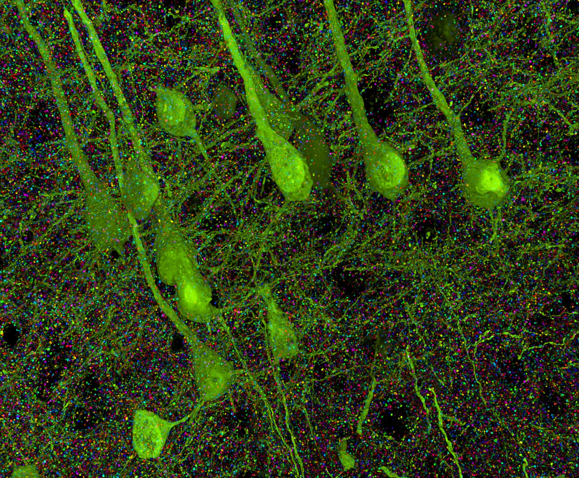Brain samples from a mouse, bioengineered so that particularly large neurons express fluorescent protein, allowed researchers to visualize synapses against the background of the neurons they linked.