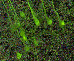 Brain samples from a mouse, bioengineered so that particularly large neurons express fluorescent protein, allowed researchers to visualize synapses against the background of the neurons they linked.