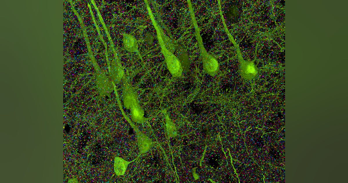Array tomography reveals synaptic distinctions in imaging brain ...