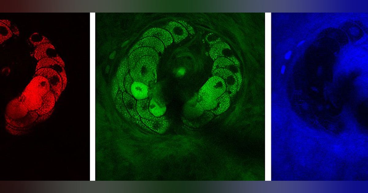 CELL BIOLOGY/RAMAN SPECTROSCOPY: Label-free, subcellular images ...