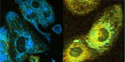 Cell fluorescence reveals metabolic activity. Cell fluorescence reveals metabolic activity.