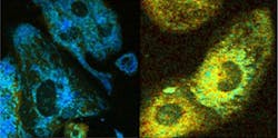Cell fluorescence reveals metabolic activity.