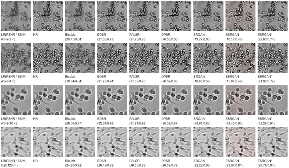 These images of human lung carcinoma cells and mouse skeletal muscle cells illustrate the performance of various resolution enhancement procedures. The left column presents low-resolution images downsampled from the high-resolution images in the second column. The new AI model results are in the right-most column, outperforming other reconstruction techniques in metrics of both accuracy and realism.